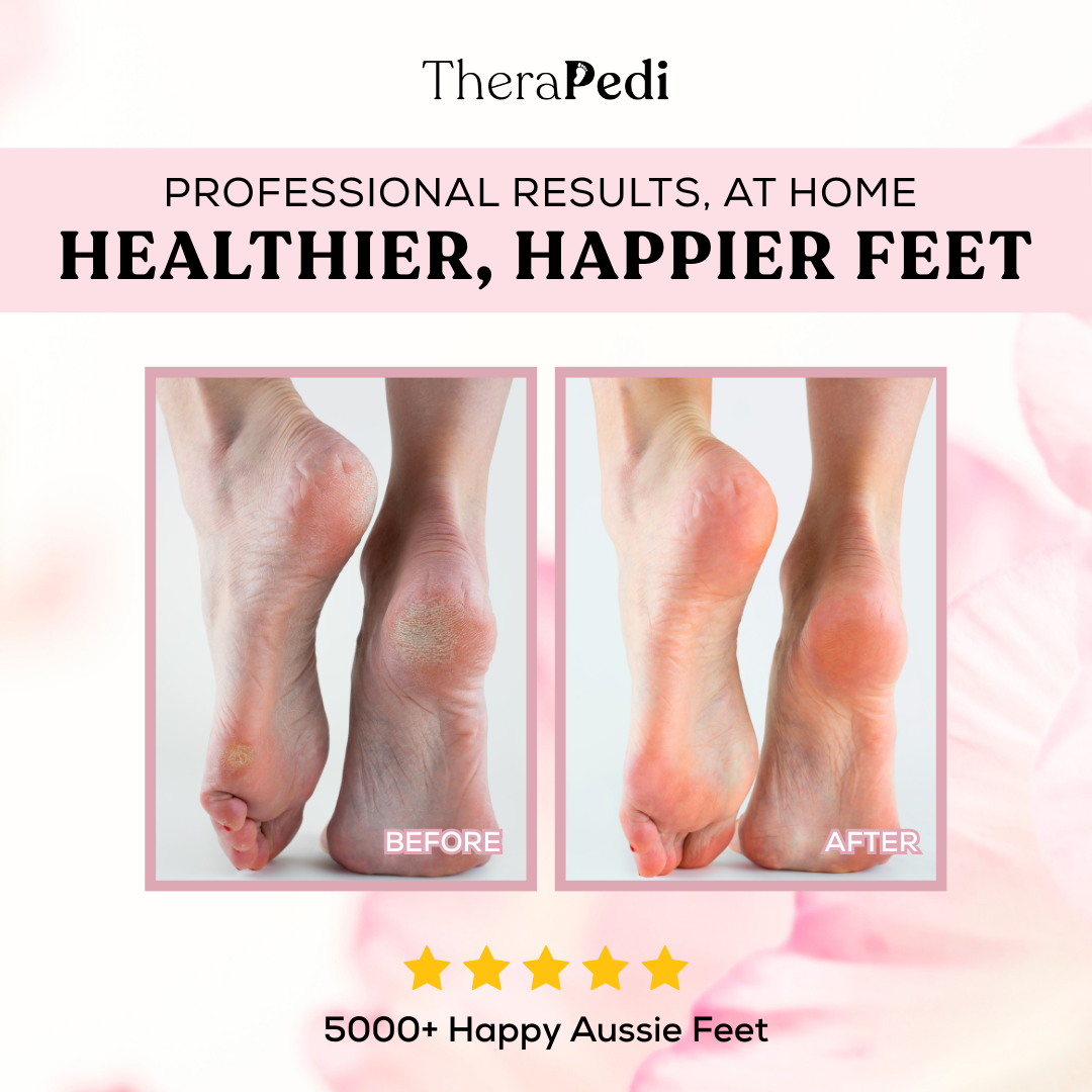 TheraPedi Electric Foot Callus Remover