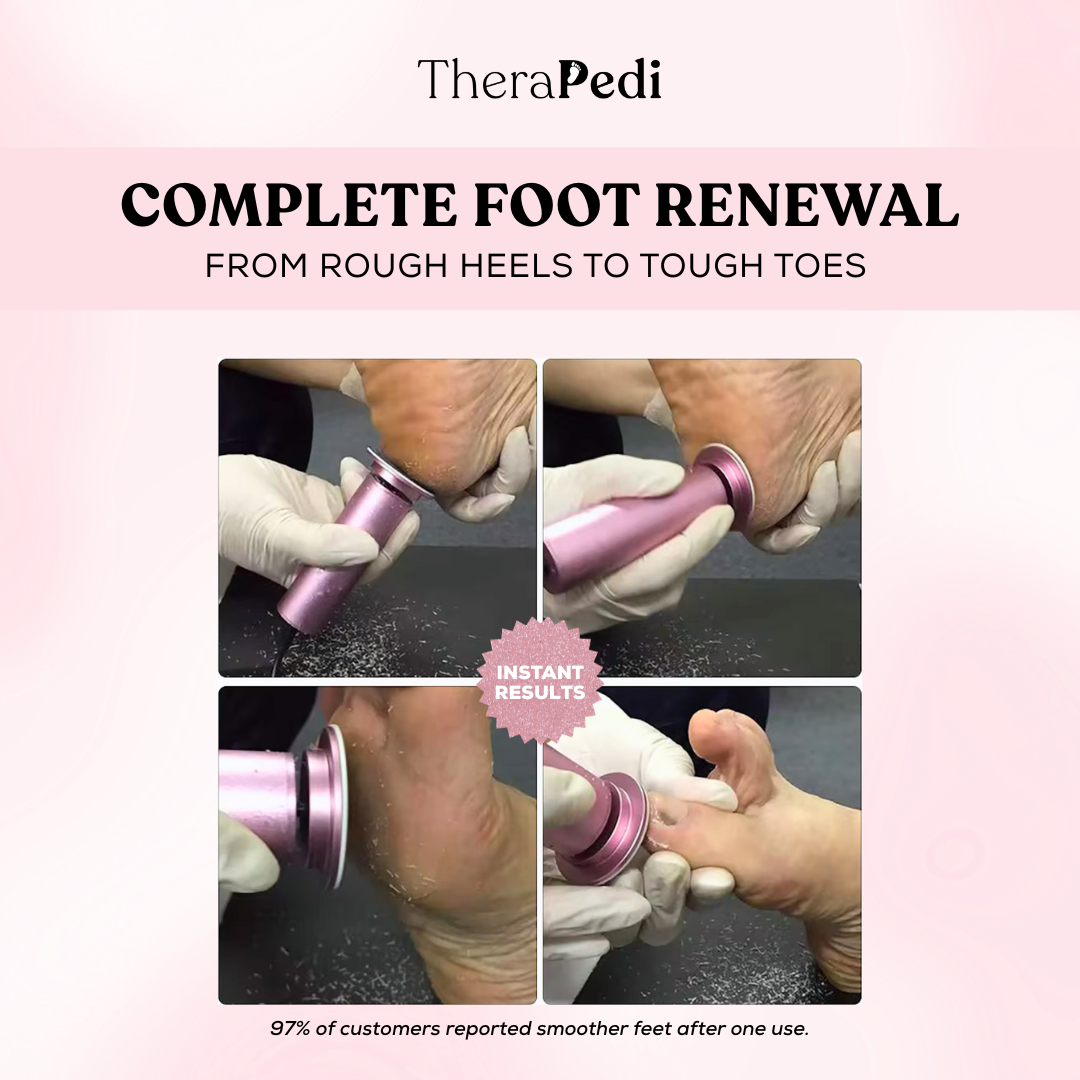 TheraPedi Electric Foot Callus Remover